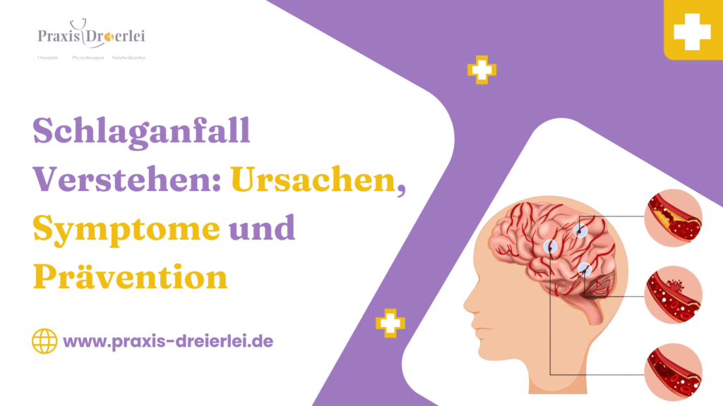 Schlaganfall Verstehen: Ursachen, Symptome und Prävention